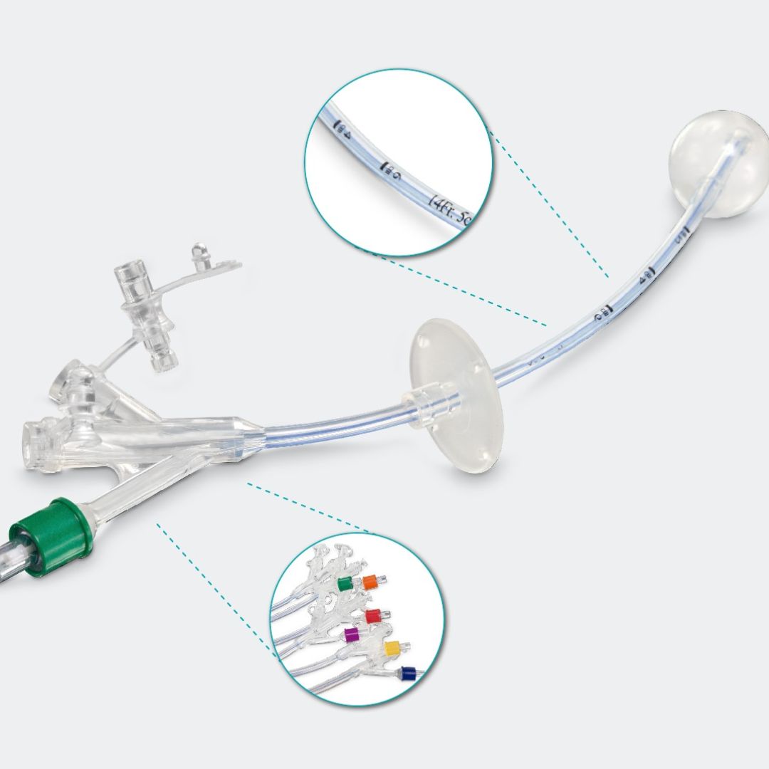 Gastrostomia Endoscópica Percutânea (PEG)